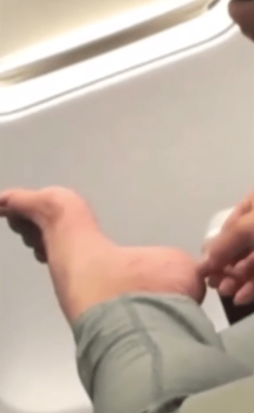 A vile viral video has emerged of a woman pulling dead skin off her feet on plane
