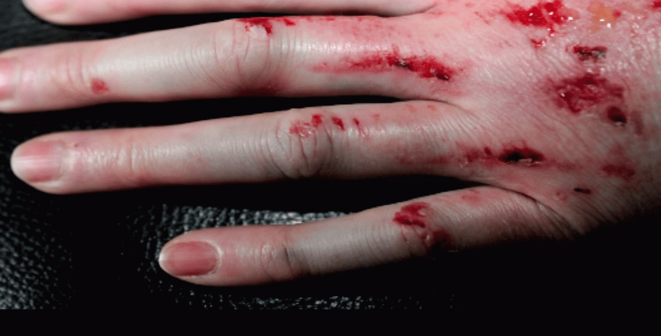  She was rushed to hospital shortly after the incident