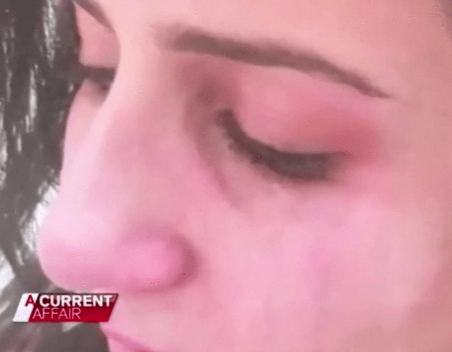  The subsequent bruising was evidence, Asmae claimed, that Faisal beat her