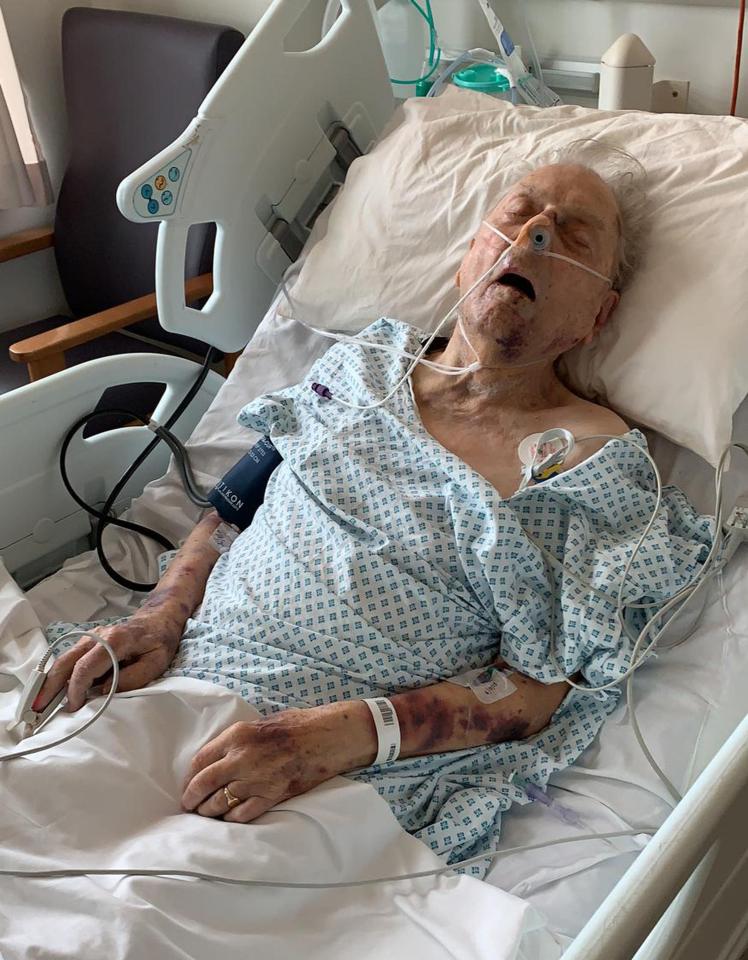  Peter Gouldstone, 98, who suffered severe injuries including two bleeds to the brain and extensive bruising on his body, died in hospital in the early hours of Friday