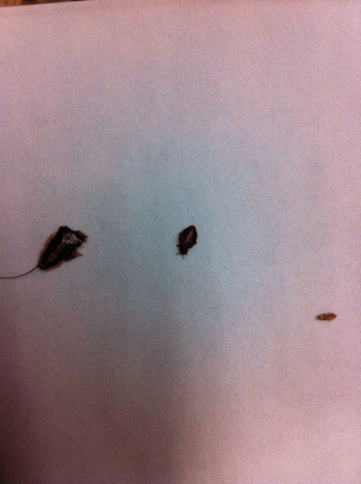 Elaine failed to get any photos of the bed bugs but a German woman in the hotel did