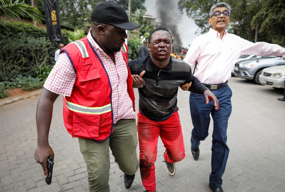  An injured man is escorted from the scene