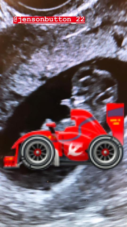 The stunning 28-year-old model then shared a snap of the scan with a racing car superimposed on top