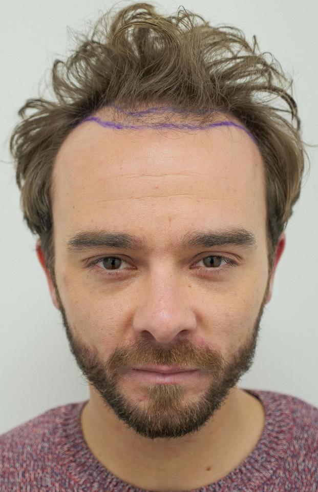 Jack P Shepherd