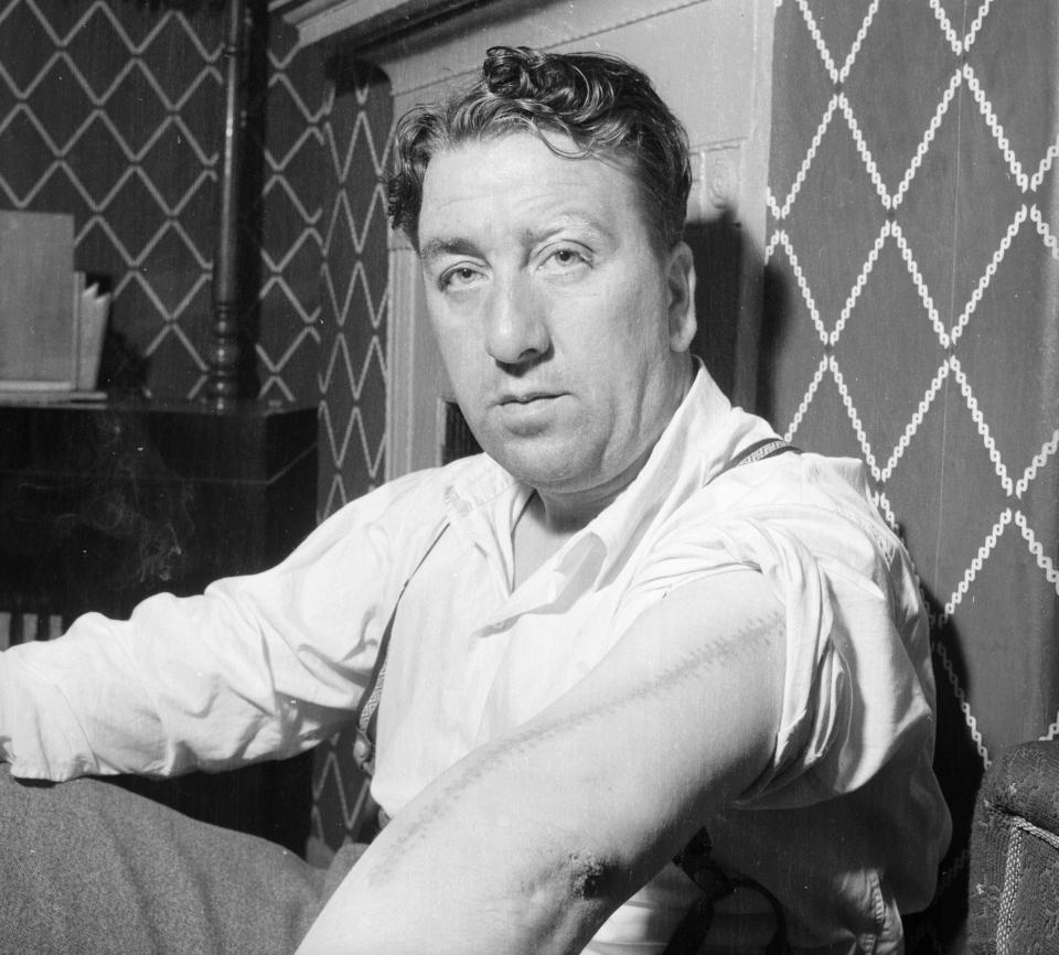 Gangster Tommy Falco showing the scar on his arm after a violent incident in which Comer was also injured