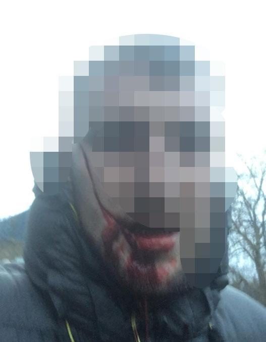  This image later circulated on social media purporting to show the victim of the knife attack