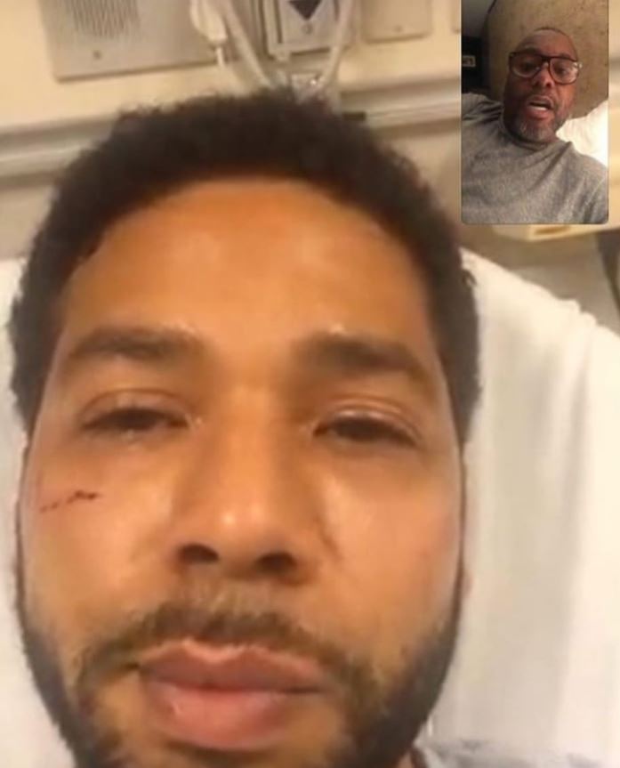 Empire director Lee Daniels shared this image of Jussie on Instagram after the attack but deleted it
