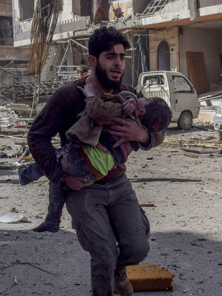  A Syrian man carries an injured child after Assad forces carried out airstrikes in Douma