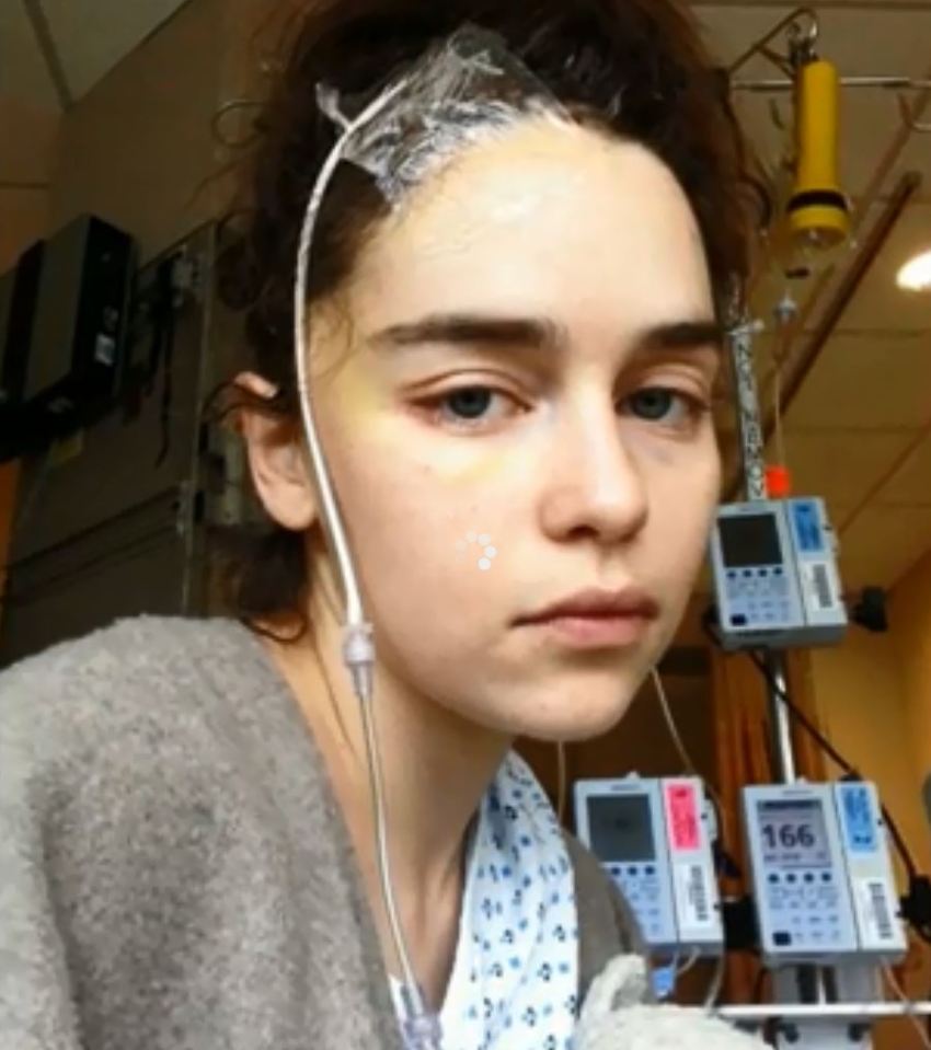  The Game Of Thrones actress first suffered a brain aneurysm in 2011