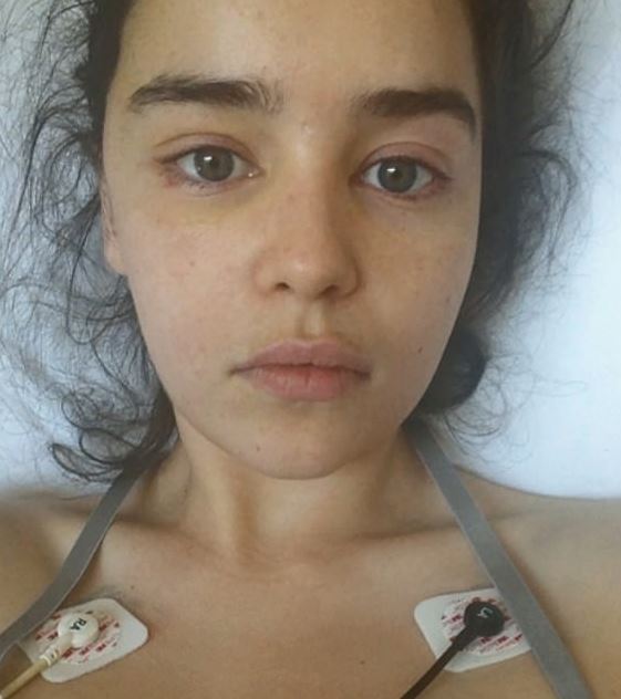  Emilia shared the harrowing images during an interview on CBS Sunday Morning