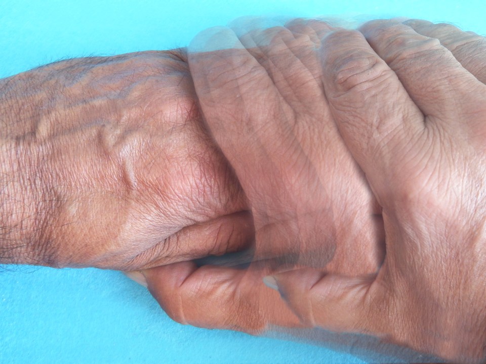 Do you know the symptoms of Parkinson's?