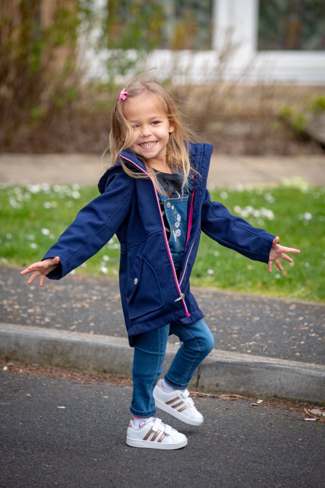  Victoria Komada has bilateral tibial hemimelia - a deformity which caused her to have deformed legs and missing bones