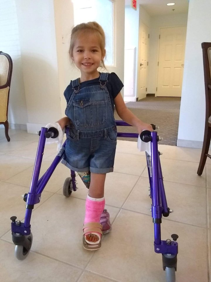  After the surgery and with the aid of a prosthetic and frame, Victoria slowly learned to walk
