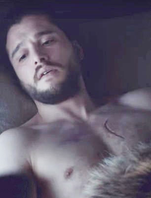  The scars on Jon's face and neck vanished while the third changed shape