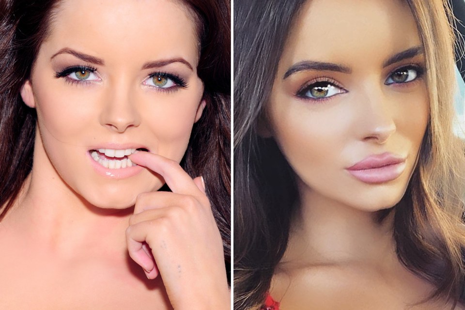 Maura, seen left as a 21-year-old, now shows off a much plumper pout