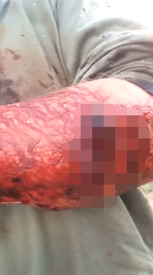  Todd was attacked twice while scouting hunting locations