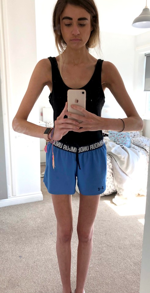  Doctors warned that she was at risk of developing sepsis or suffering a cardiac arrest at her lowest weight