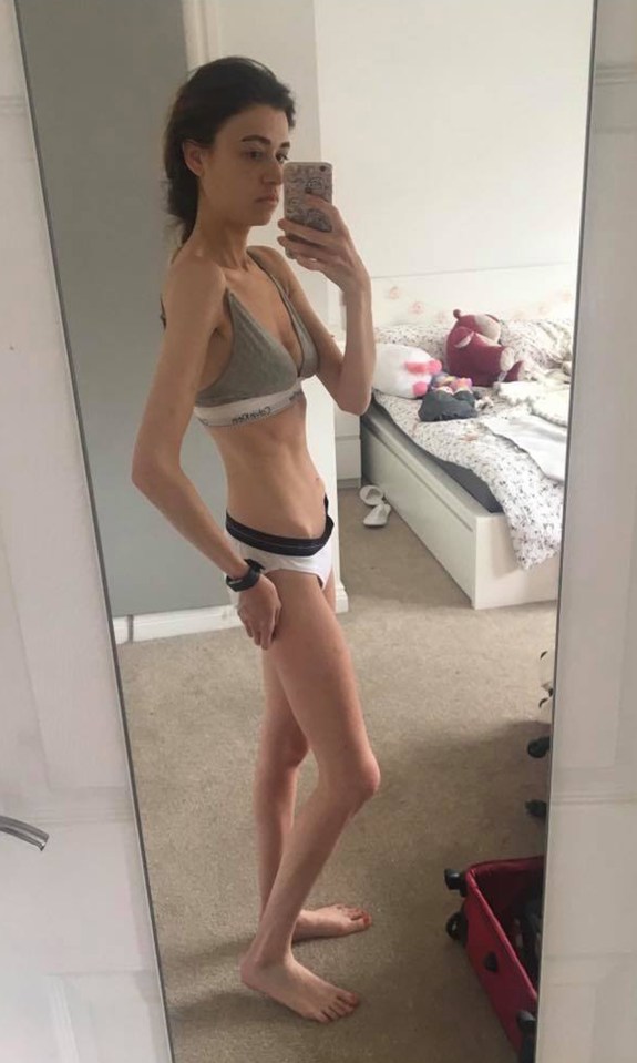  Emma first began suffering from eating disorders after her mother died when she was 18