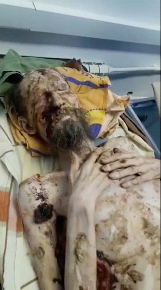  A severely wounded man reportedly rescued from a bear den in Russia