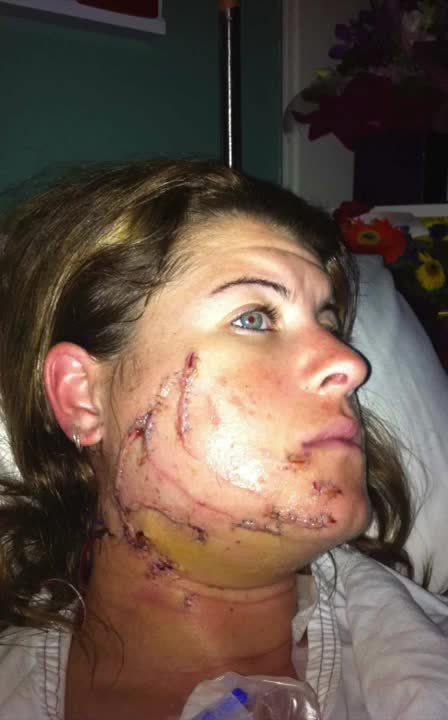  Lisa almost lost her life when a shark locked its jaw around her head