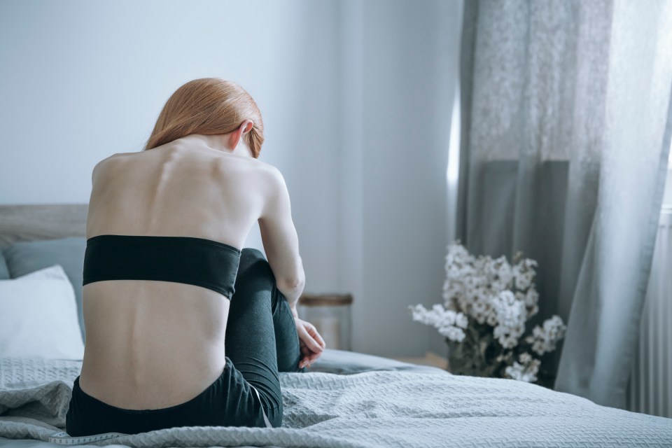  A new study claims Anorexia can be treated with drugs (file image)