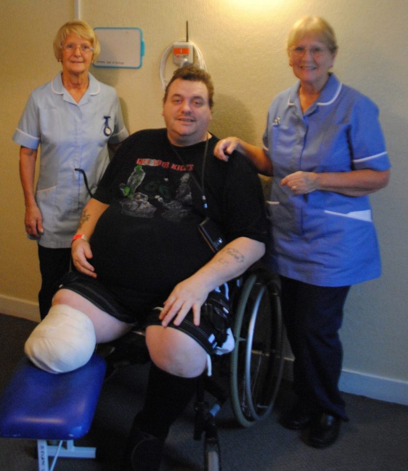  Andrew admits he didn't take his obesity seriously before his leg needed to be amputated