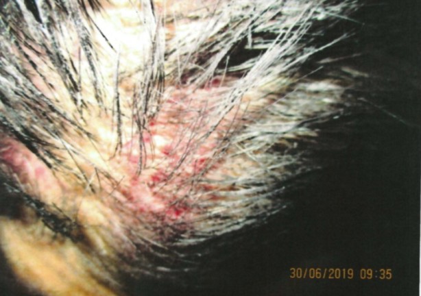  The teen also sustained injuries to his head