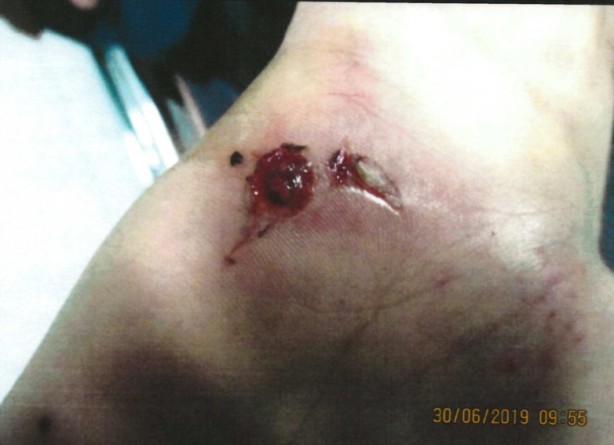 His wrist was also cut open, it is unknown how it happened