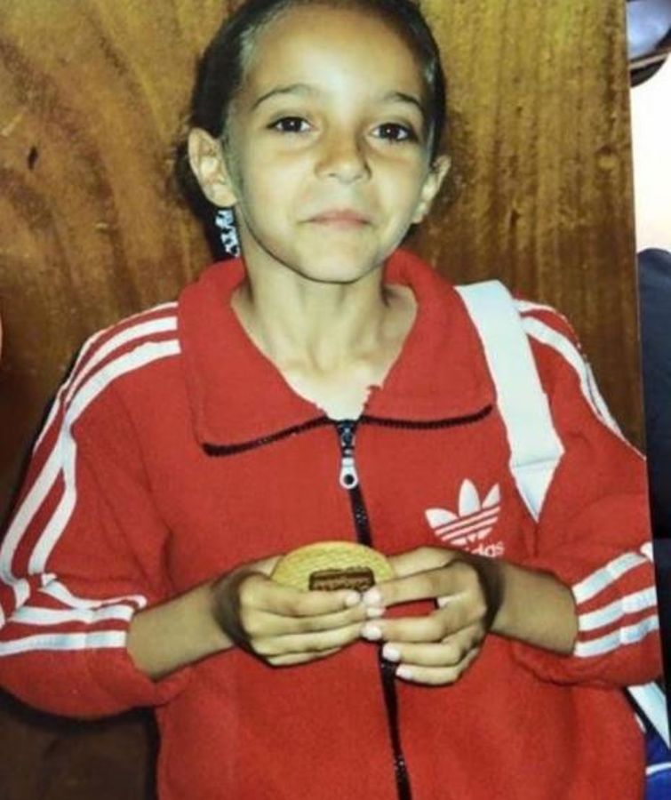  Jade struggled with anorexia as a teenager