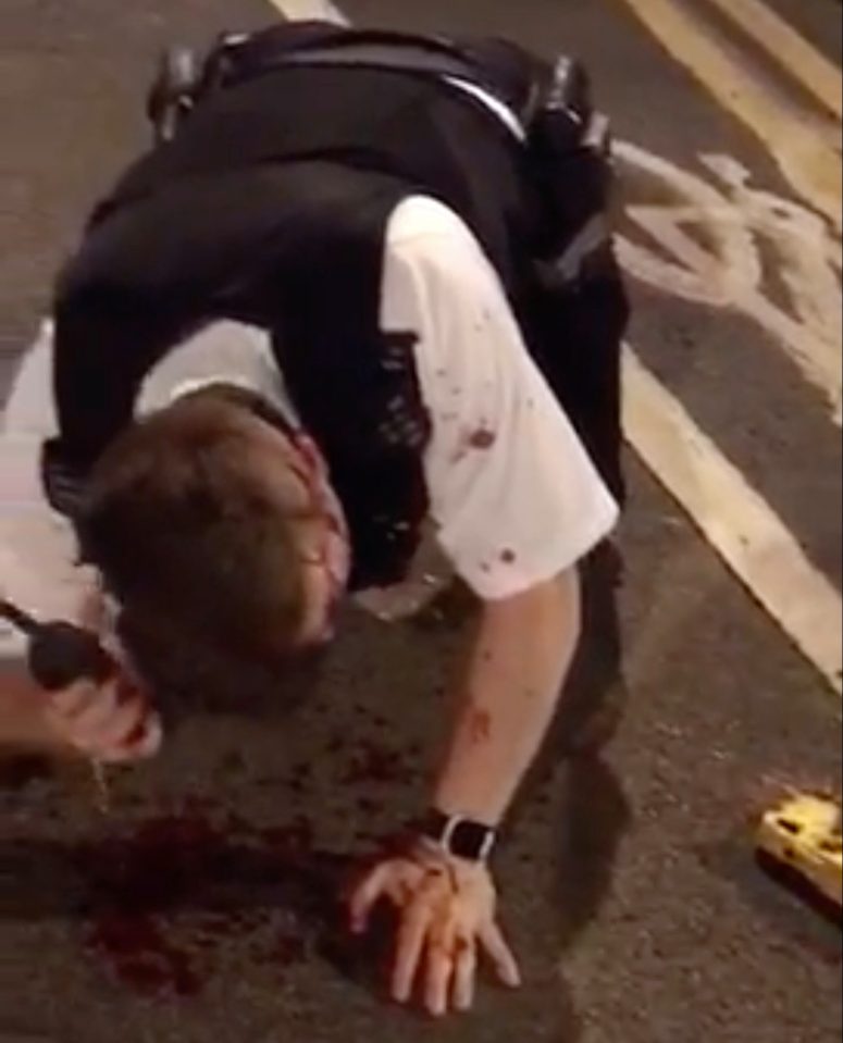  The brave PC called for an ambulance on his handset