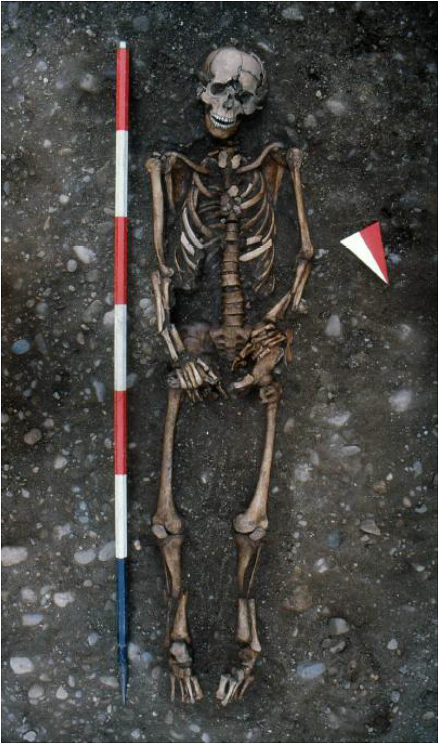 In some unusual cases, humans can be born with extra bones or not enough bones 