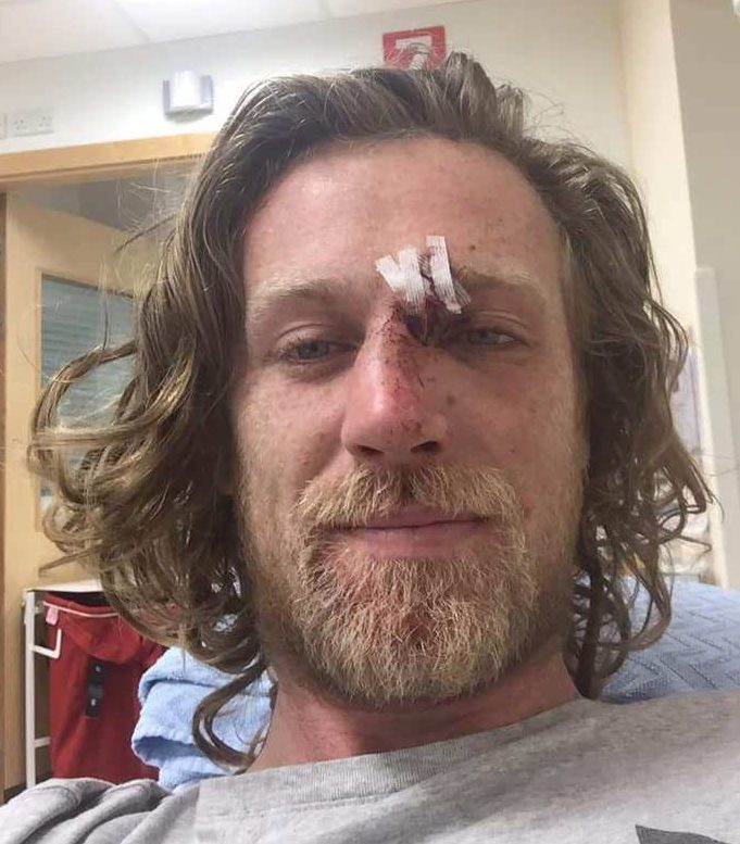  Kitesurfer Sean Murphy suffered a broken leg and other injuries during Storm Lorenzo