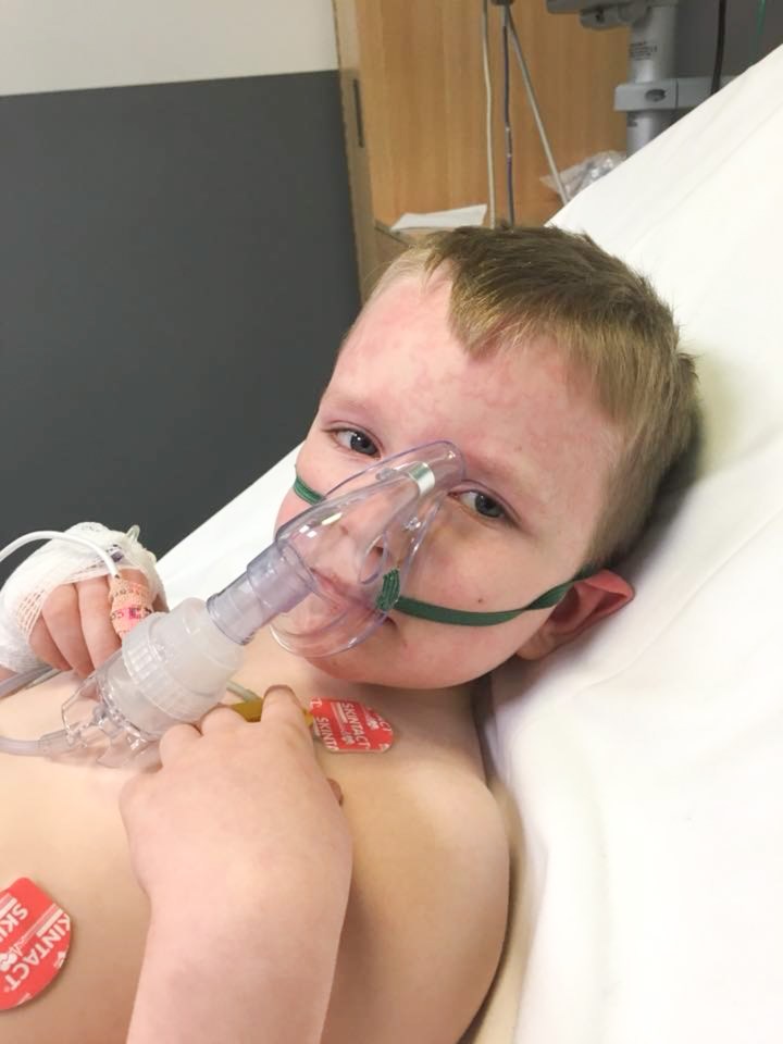  His mum ensures he wears suitable clothing in summer and winter to try and avoid reaction