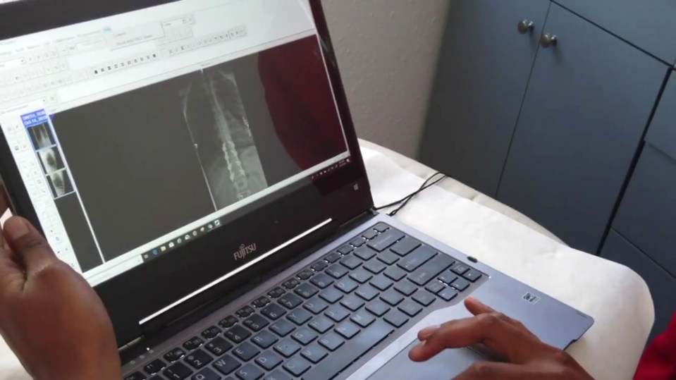 Hart reviews images of his spinal injuries on his laptop