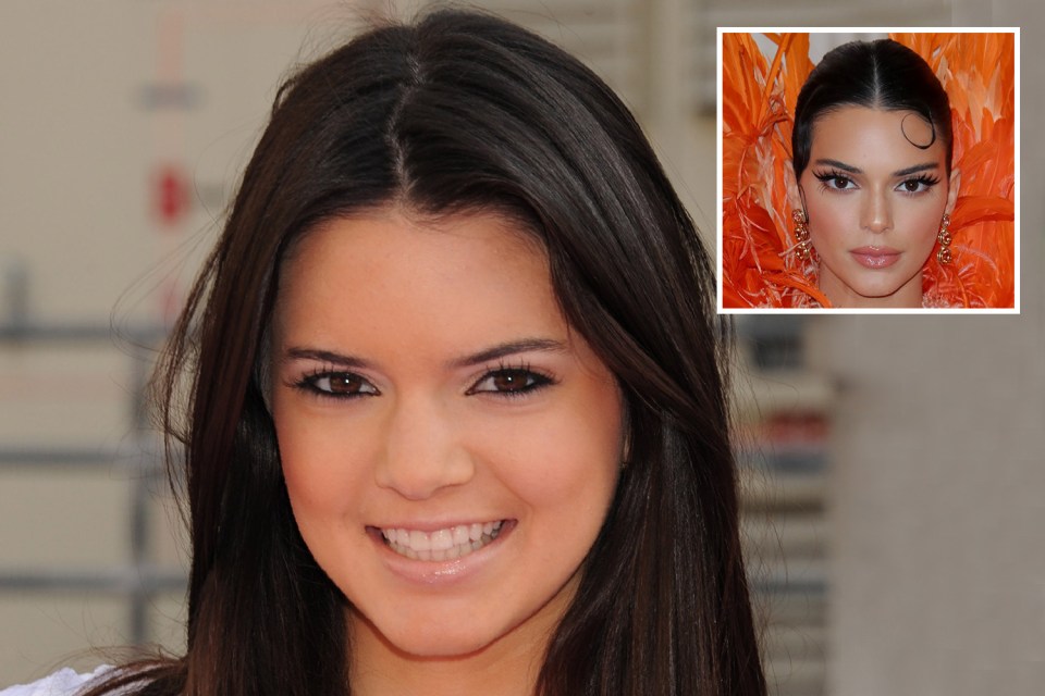 Kendall is now a successful model after starting her career 10 years ago