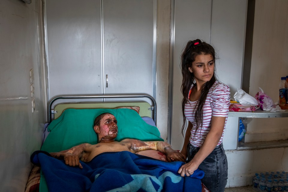 A young Kurdish SDF fighter with his girlfriend after he had been badly burnt during a battle with Turkish forces