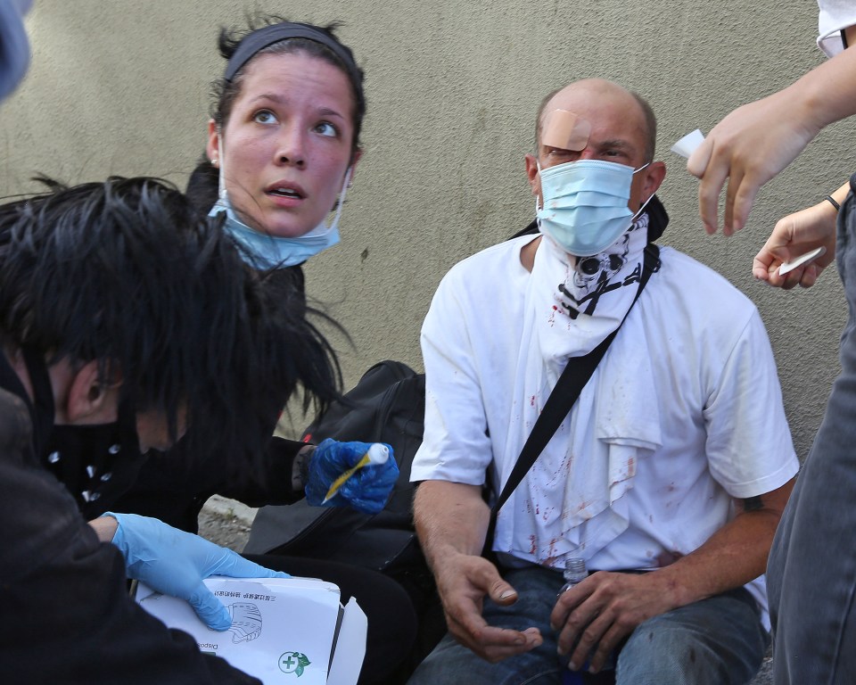  Halsey and her ex-boyfriend Yungblud gave first aid to a protester in Santa Monica