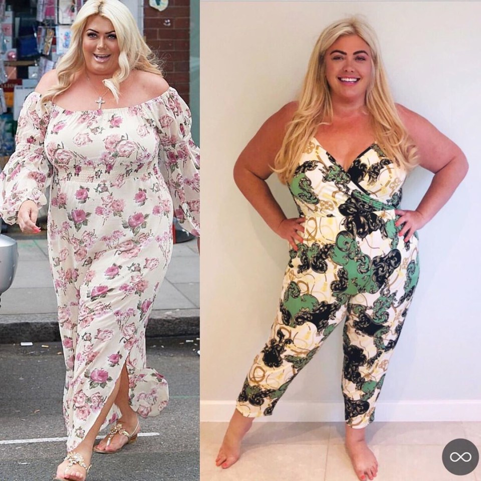  Gemma Collins, 39, showed off her incredible weight loss after getting injections