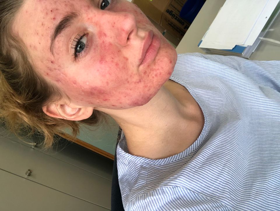 Mina says that she has heard strangers talking about her skin 