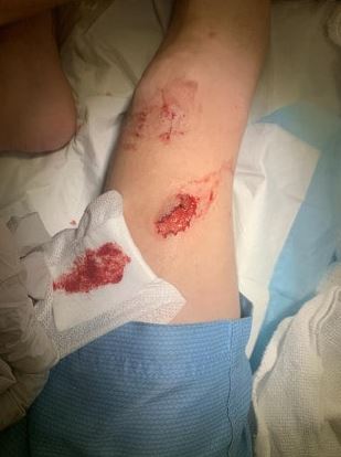 The beast latched onto Clifford's leg during the terrifying ordeal