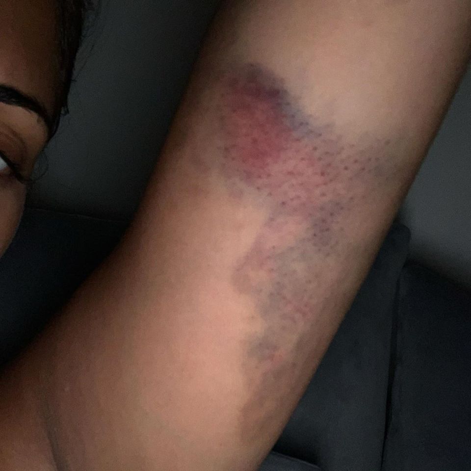 She said the emotional and physical abuse left her feeling 'worthless'
