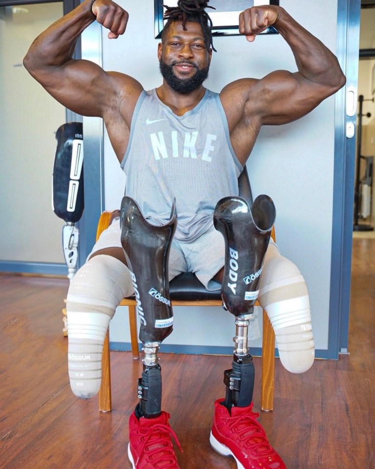 The professional bodybuilder wears two prosthetic legs