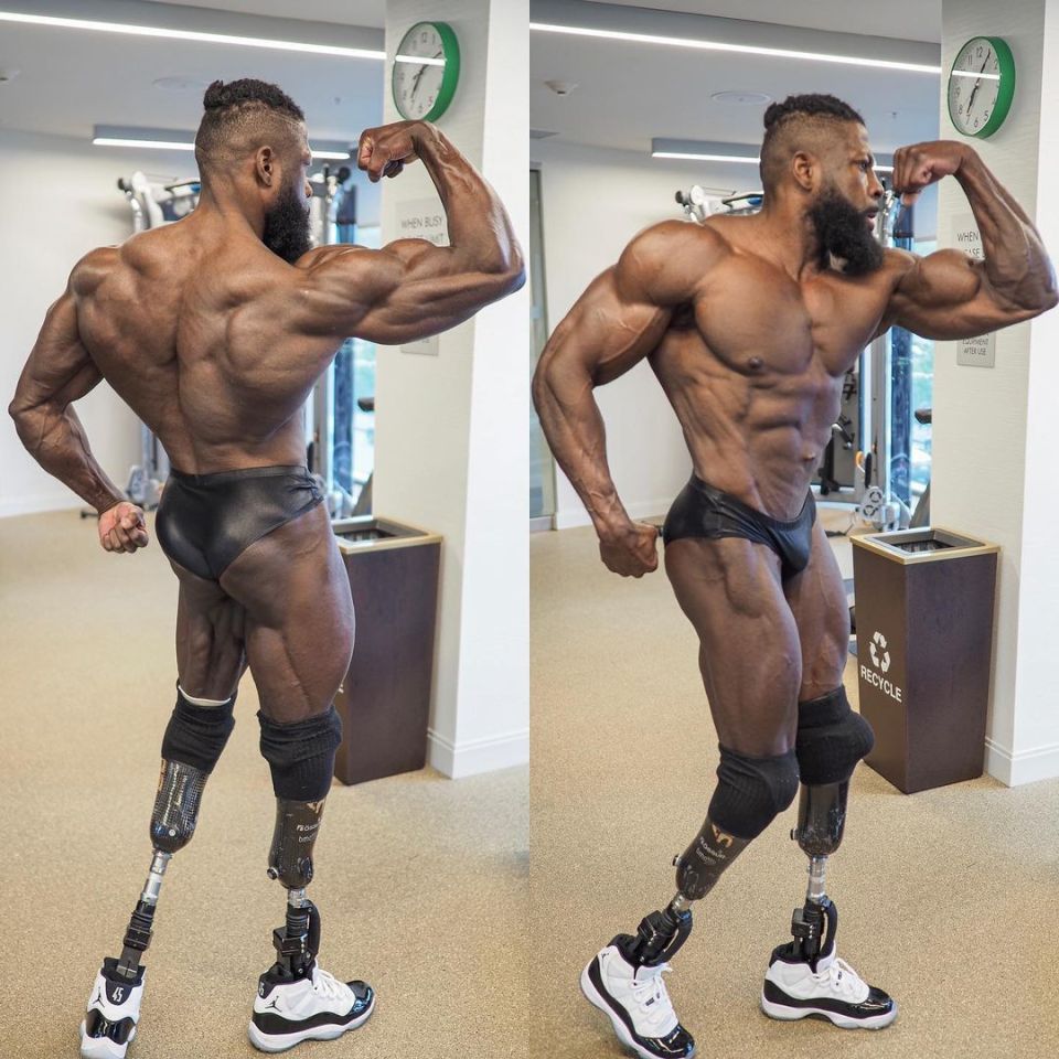 Bionic Body has amassed 400,000 followers on his Instagram profile