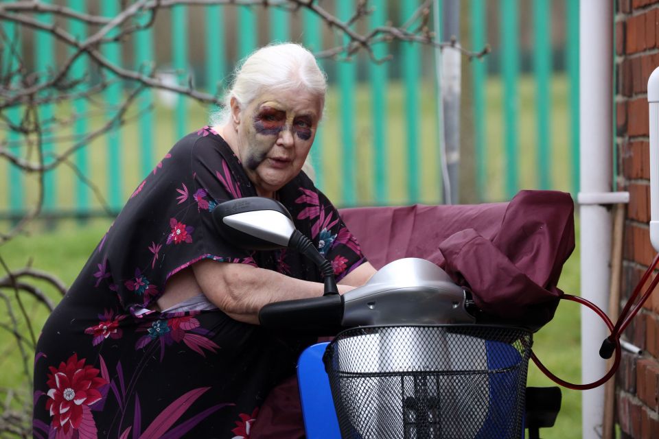 Ida believes the thugs wanted to steal her scooter so they could sell it for drug money