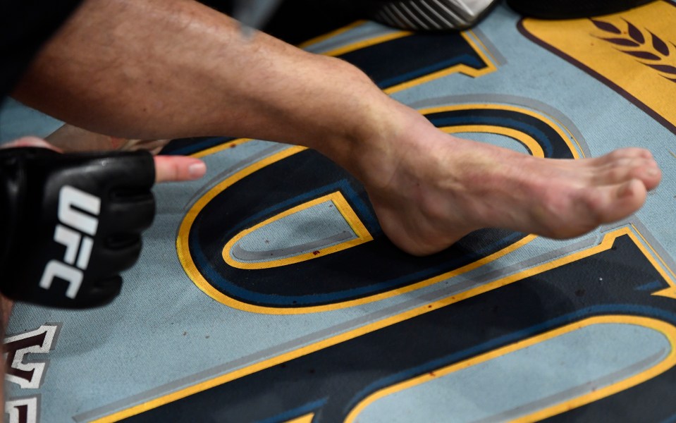 Conor McGregor's injured ankle