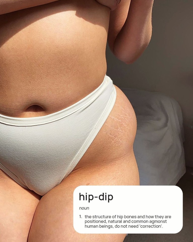 Says it all really - 'hip-dips' are part of your hip bones and don't need 'correcting'