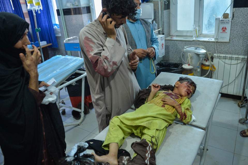 A child lies on a bed awaiting treatment after he was injured during skirmishes between Afghan forces and the Taliban