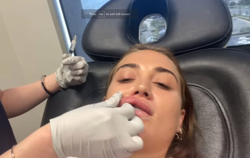 The Love Island star gave a behind-the-scene look at the procedure