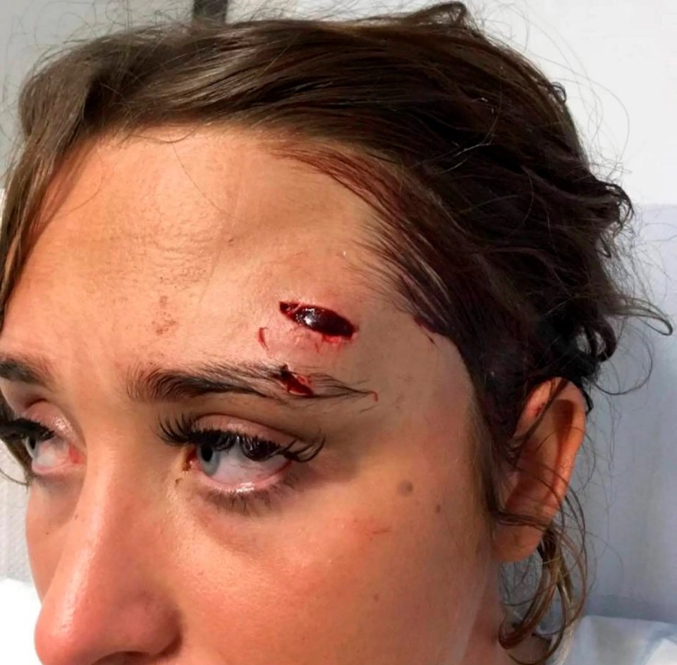 Prosecutors accept Haylett's intention was to "swill her with a drink" and not to cause injury