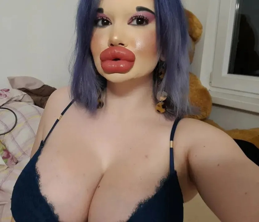 Andrea Ivanova is on a mission to have the biggest lips in the world